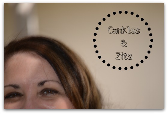 Cankles and Zits - me hiding so you can't see the zits!